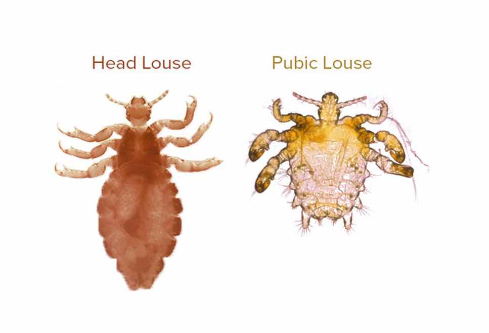 Lice In The Pubic Hair Caraway Seeds Health Benefits