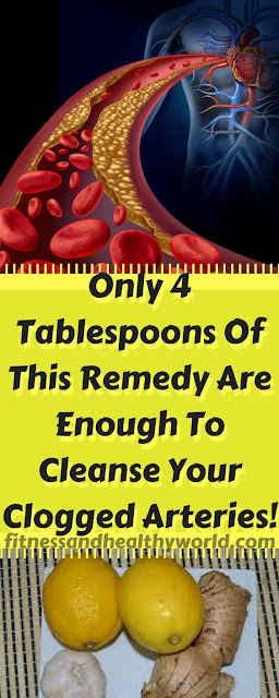 A SCANDAL in Clinics and Hospitals! This is What They Want to Hide: Only 4 Tablespoons of This Remedy Are Enough to Cleanse Your Clogged Arteries!