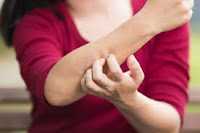 10 Obat Gatal-Gatal Jamur Tradisional Terbukti Paling Manjur