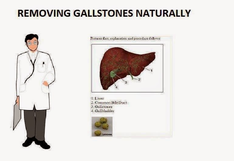 ShiningSoul 6 Days Apple Juice Treatment to Remove Gallstones Naturally