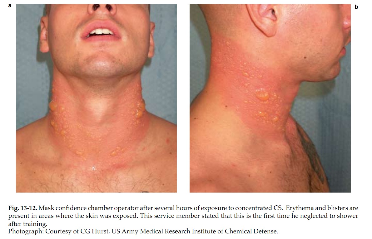 NationalRevolutionary Alternative Practical tips for the Streetfight