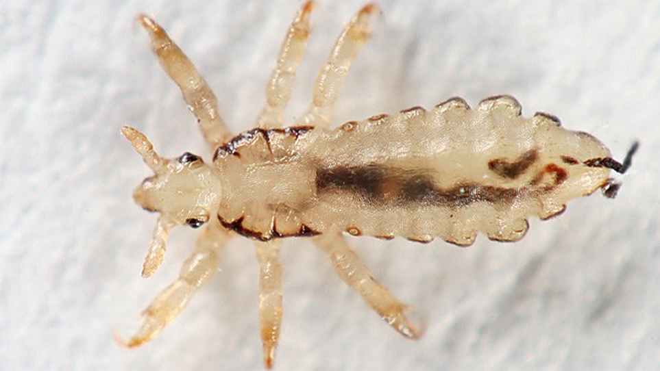 What Does Lice Look Like In Your Hair Caraway Seeds Health Benefits