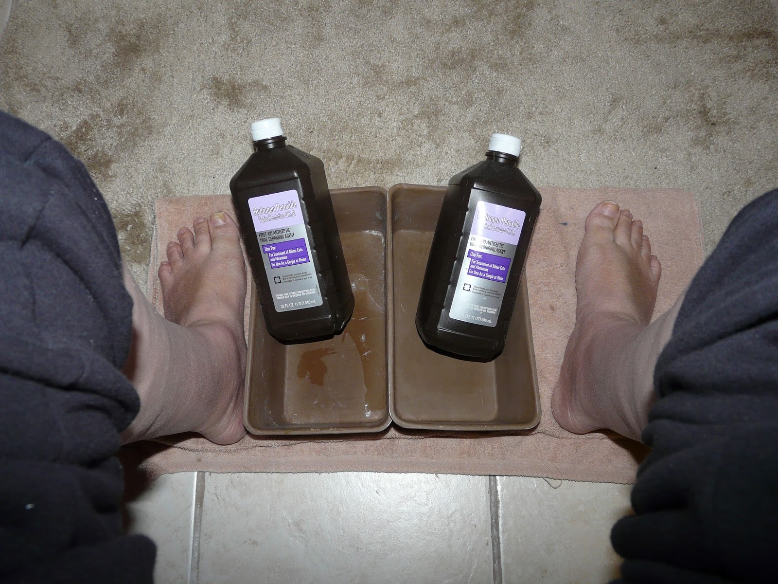The "Secret" is Gratitude Curing Toenail Fungus Using Hydrogen Peroxide
