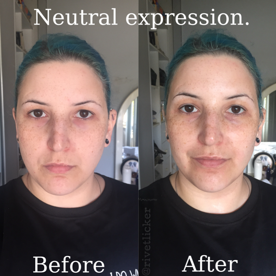 my perfect eyes facial kit