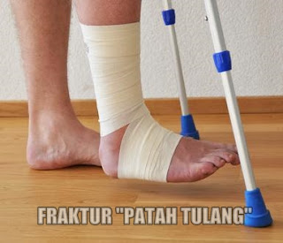 Pengobatan Patah Tulang Paling Ampuh Pengobatan Patah Tulang Paling Ampuh