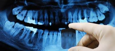 LAMEL - Liga Acadêmica de Medicina Legal da UPF : Como se identifica um