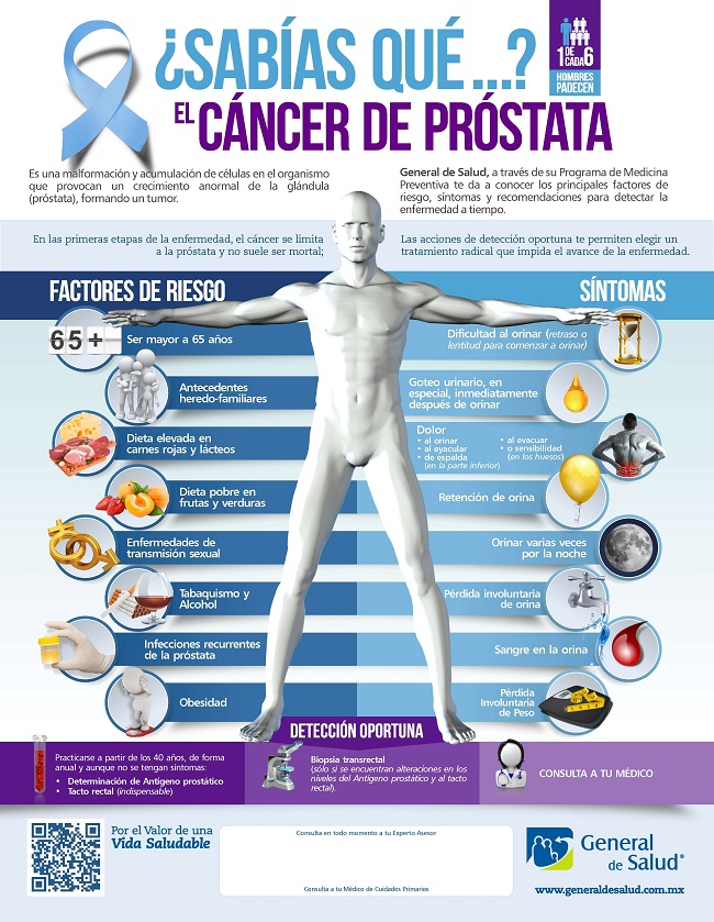 «Somos muy optimistas en la esperanza de vida en cáncer de próstata»