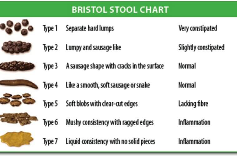 Health Guide What do your stools say about your overall health?