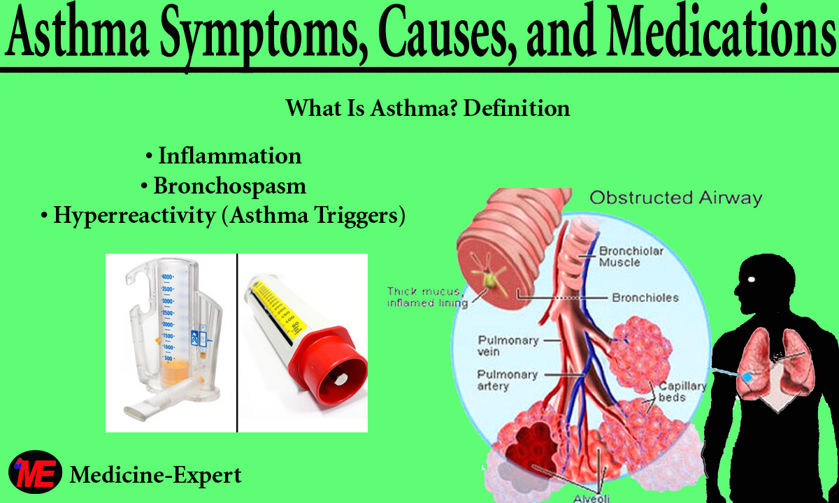 Asthma Symptoms, Causes, and Medications Medicine Expert