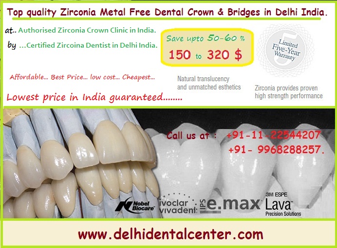 Zirconia Dental Crowns Cost In India Prices from 150 to 277