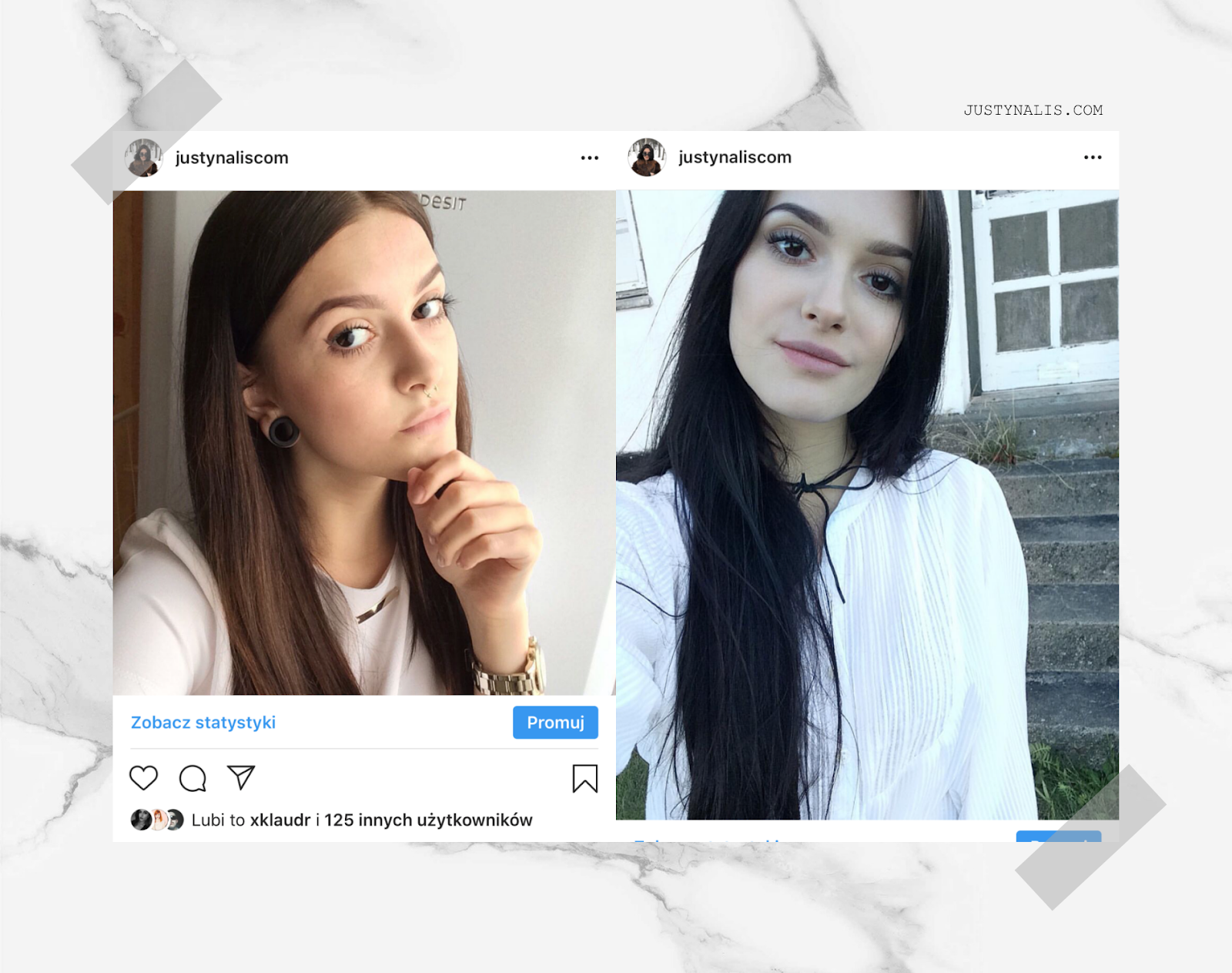 Powiększanie ust kwasem hialuronowym efekty powiększanie ust efekty, powiększanie ust kwasem hialuronowym przed i po, zabieg powiększania ust, powiększanie ust opinie, usta po kwasie