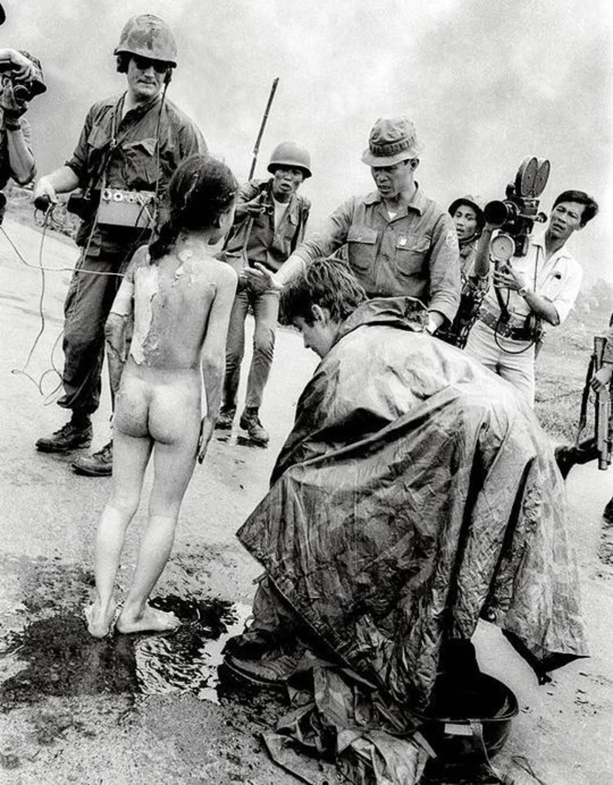 VIETNAM VETERANS GIVE FIRST AID TO THE LITTLE NAPALM GIRL