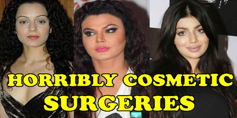 Bollywood Actresses Who Looks Horribly in Plastic Surgeries Plastic