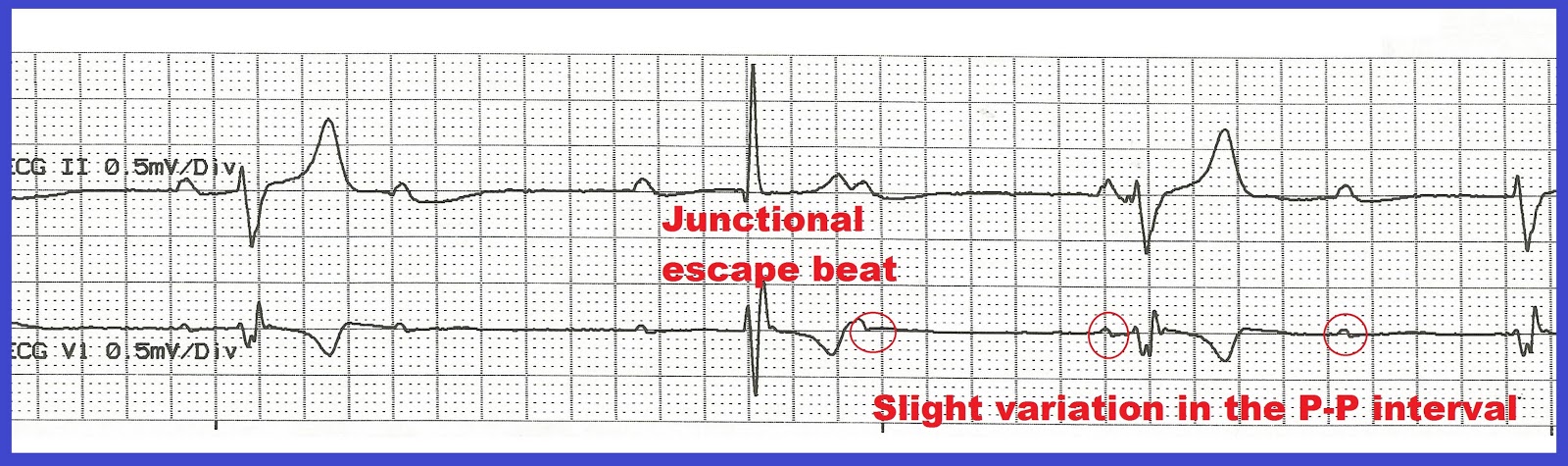 Practice EKG Rhythm Strips 168