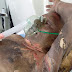Caraubense ateia fogo em seu próprio corpo, não resiste e vem a óbito no hospital
