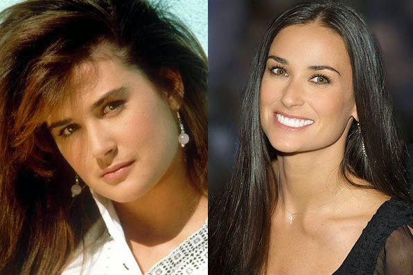 Demi%2BMoore%2BPlastic%2BSurgery-19.jpg
