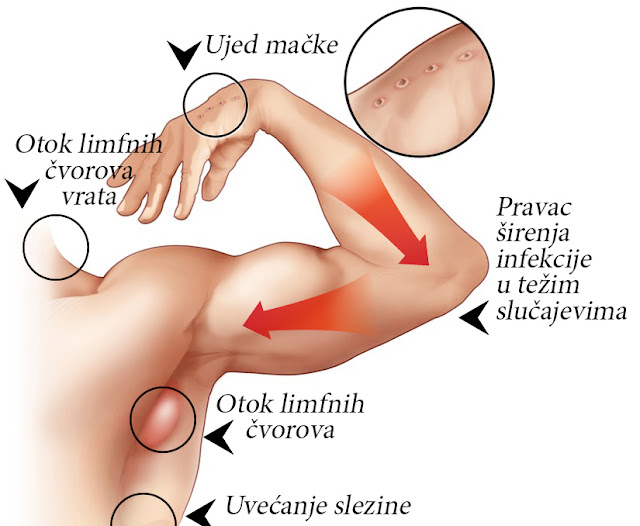 Simptomi bolesti mačjeg ogreba - Panvet Subotica