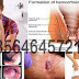 Harga Obat BAB Disertai Darah Segar thumbnail
