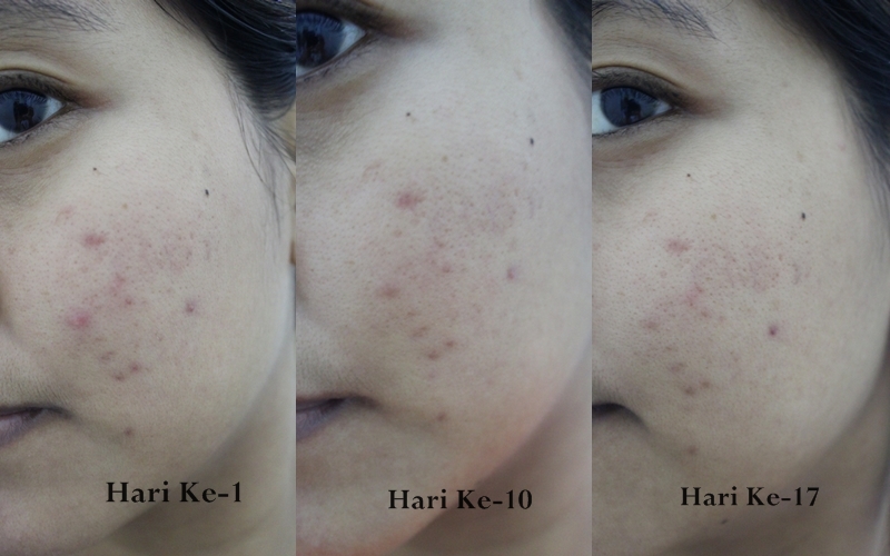 Flowrin S Note Review H2 Health And Happiness Pure Skin