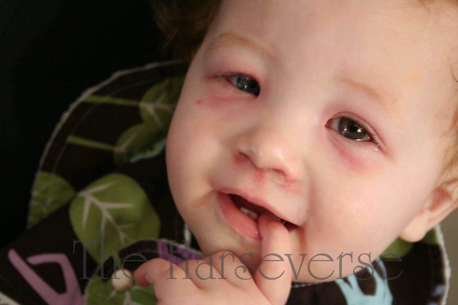 The Harseverse Poor Baby