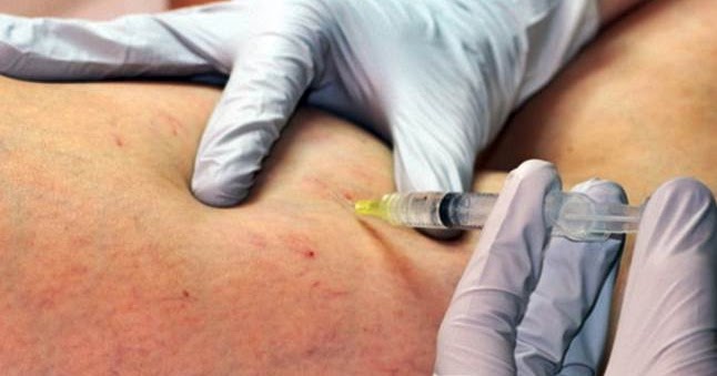 gros de varicoseza tratați venele varicoase prin remedii populare