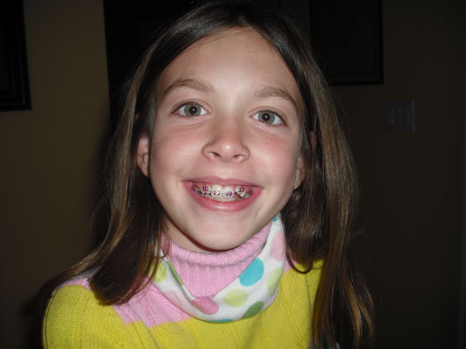 a day at a time brace face!