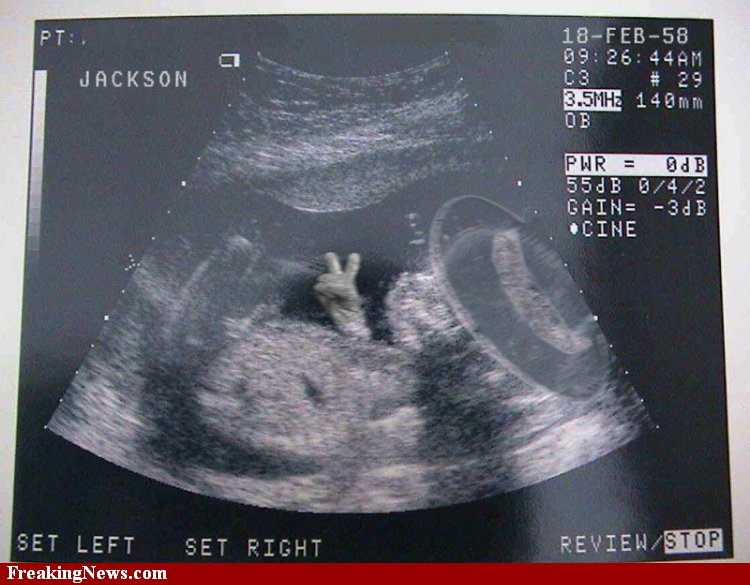 Lawak lawak pilihan cam haram: Ultrasound Funny
