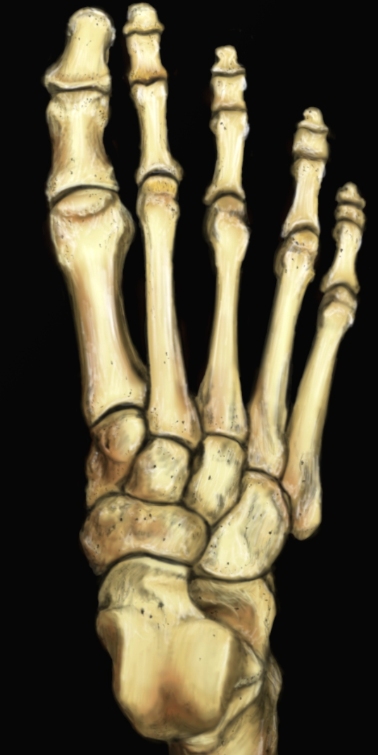 Un médecin du sport vous informe Fractures des métatarsiens, des