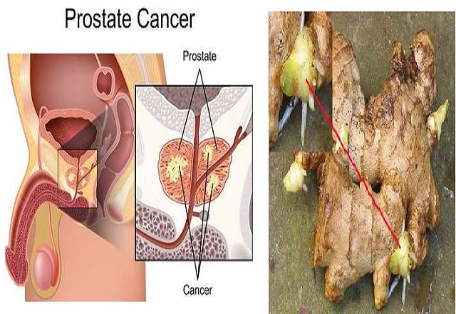 el jengibre y la prostata el jengibre y la prostata