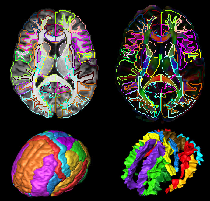 Brain imaging. Brain find Зебра. Brain Imaging Tools.