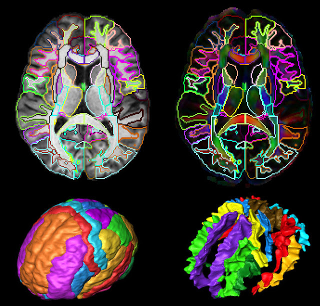 Brain Jack Image: Brain Imaging