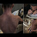 Meet the SNAKE BOY who sheds his skin every 41 days eversince he was born!