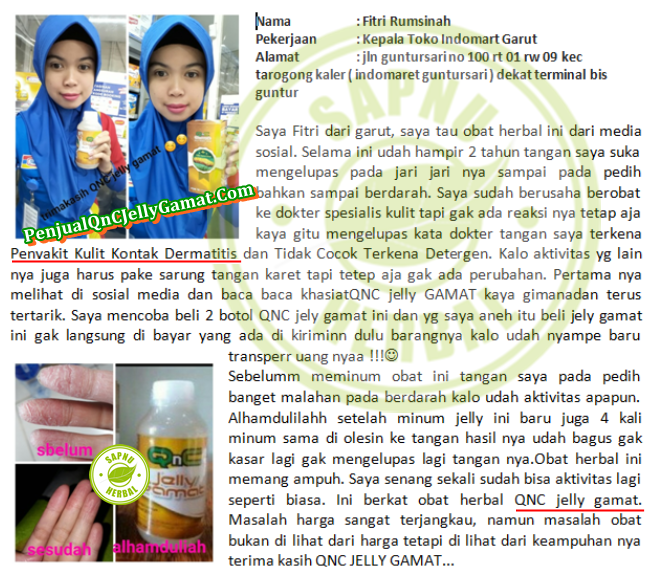 Cara Menghilangkan Gatal di Selangkangan Paha yang Terbukti Mujarab ~ TESTIMONI JELLY GAMAT QNC Cara Menghilangkan Gatal di Selangkangan Paha yang Terbukti Mujarab ~ TESTIMONI JELLY GAMAT QNC