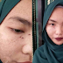 'Menyesal guna produk ini' - Kulit muka bersisik selepas guna produk kecantikan