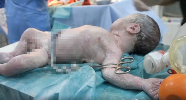 Masya Allah! Setelah Divonis Meninggal, Bayi Korban Pemboman Suriah Ini  ‘Hidup Lagi’
