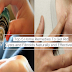 5 Best Natural Treatment To Get Rid Of Cysts And Fibroid That Actually Work