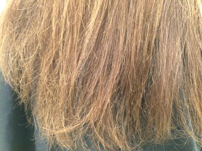 La caída de los cabello el adelgazamiento el vértigo