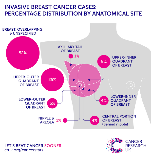 Breast Cancer, Definition and Indication Of Breast Cancer