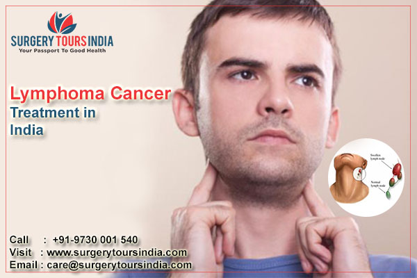 Lymphoma Cancer Treatment