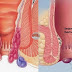 APA OBAT BAB BERLENDIR thumbnail