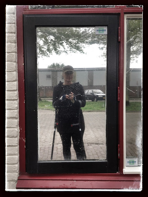 Micro fracturing, meniscus scheur, artrose, kraakbeen slijtage