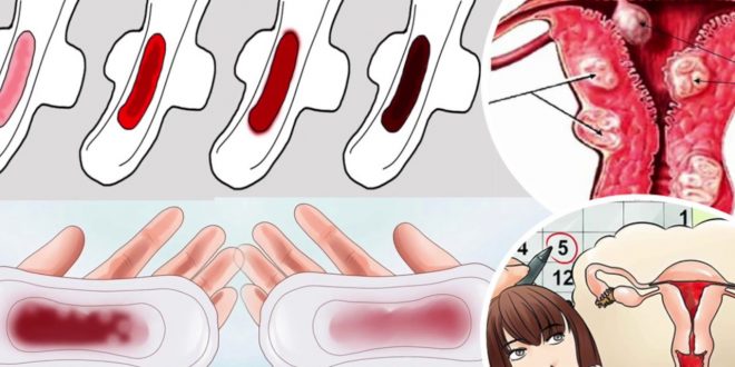 Cara Mengatasi Darah Haid Berwarna Coklat Kehitaman Cara Mengatasi Darah Haid Berwarna Coklat Kehitaman