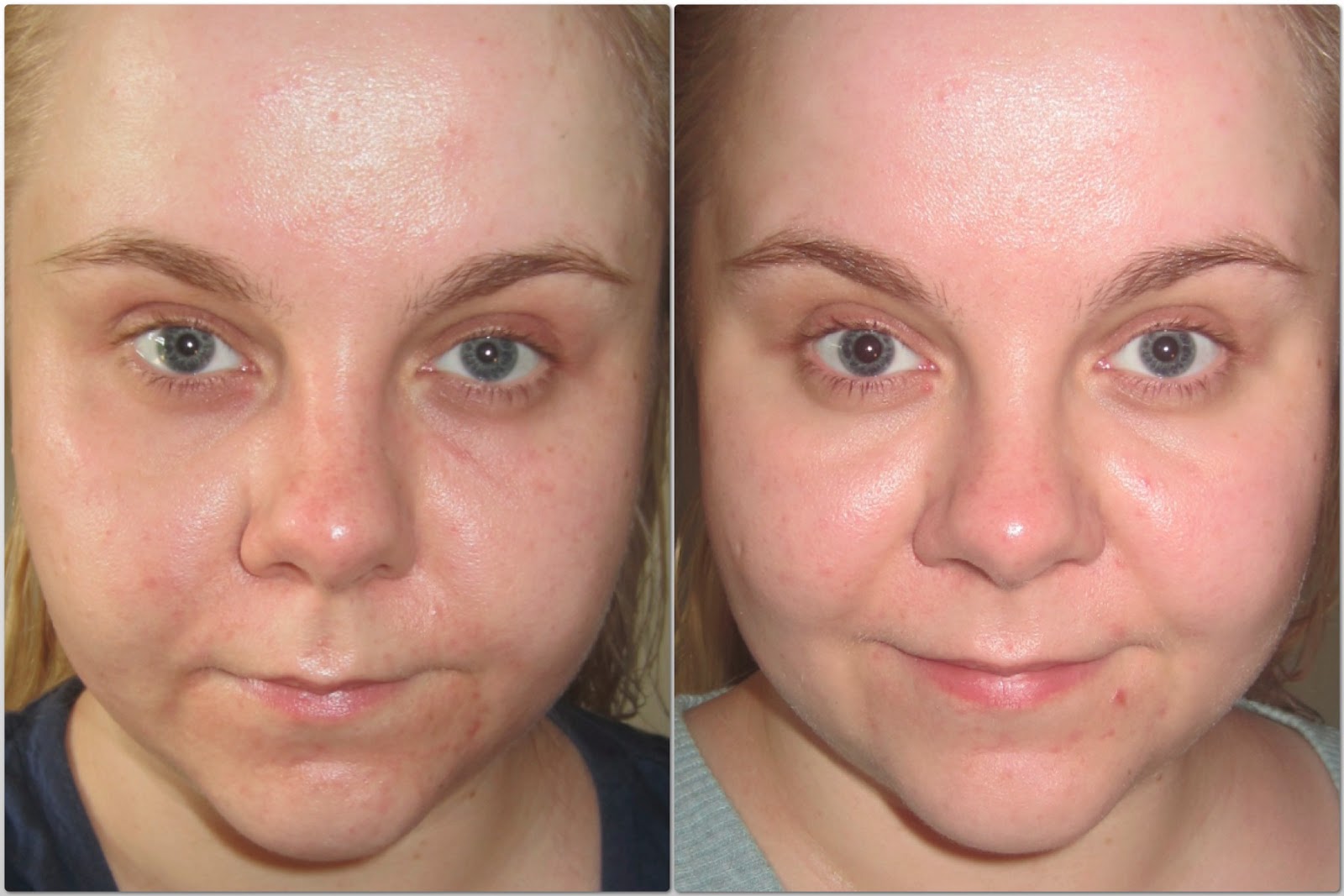 The Dodo way Wunder Cream... Review/Rave Mario Badescu Control Cream!