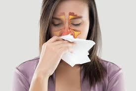 Cara Menyembuhkan Sinusitis Kronis Tanpa Operasi Cara Menyembuhkan Sinusitis Kronis Tanpa Operasi
