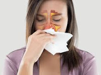 Cara Menyembuhkan Sinusitis Kronis Tanpa Operasi Cara Menyembuhkan Sinusitis Kronis Tanpa Operasi