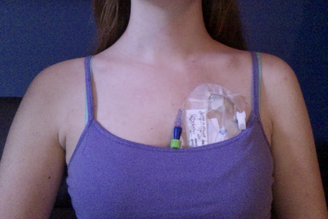 Living the Chronically Wonderful Life POTS, EDS, gastroparesis, and