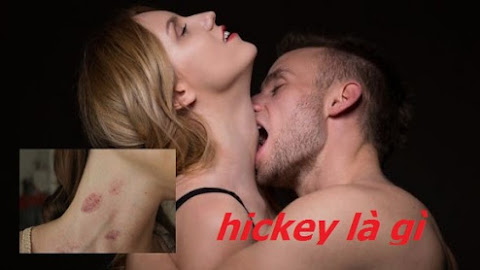 Hickey kiss là gì? Hickey làm như thế nào? Vết hickey bao lâu mới hết?