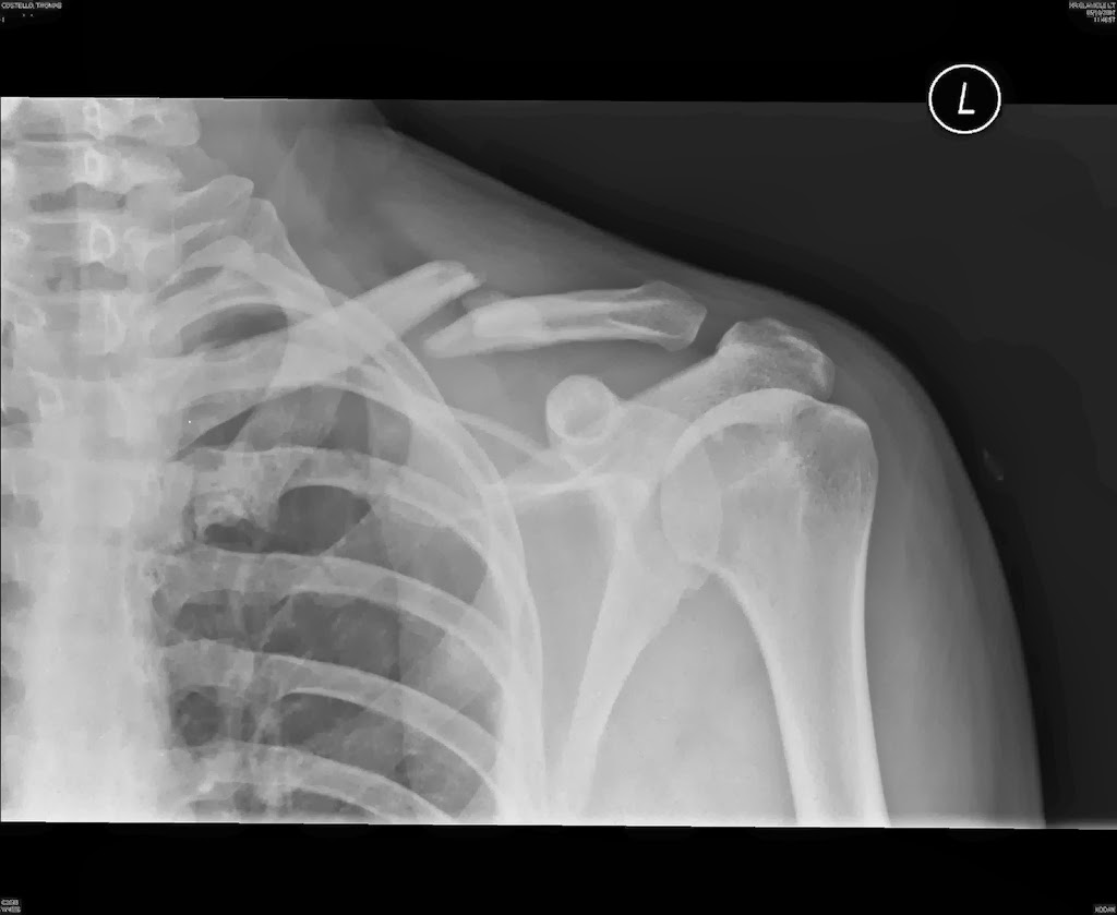 The Xray The Science