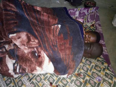  Photos: Married man gets stuck inside his lover while having sex at a guest house in Uganda