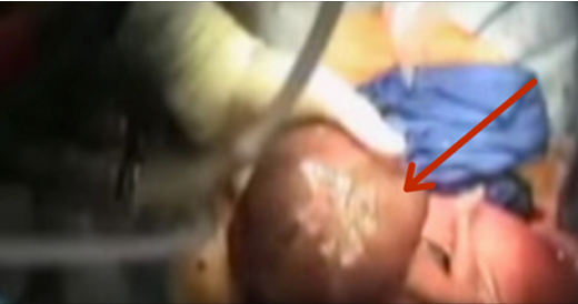 Elle veut savoir le sexe de son bébé. Mais ce que les docteurs voient est choquant!